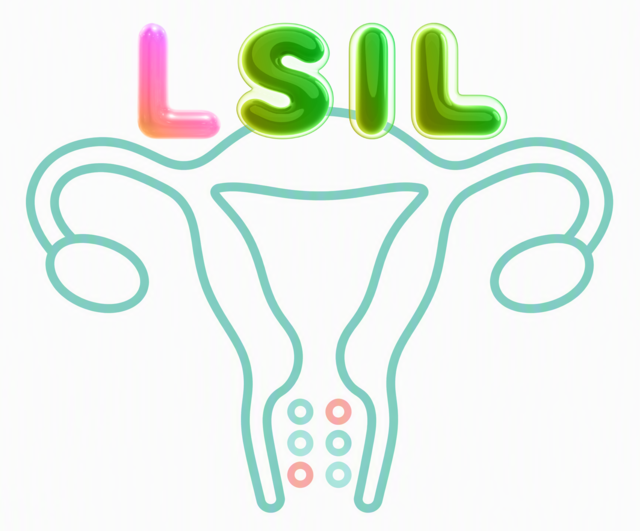 LSILのイメージイラスト